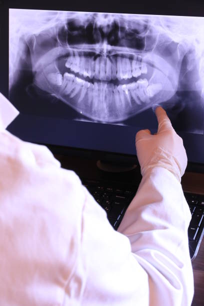 Tooth Infection Emergency Dentist in OH