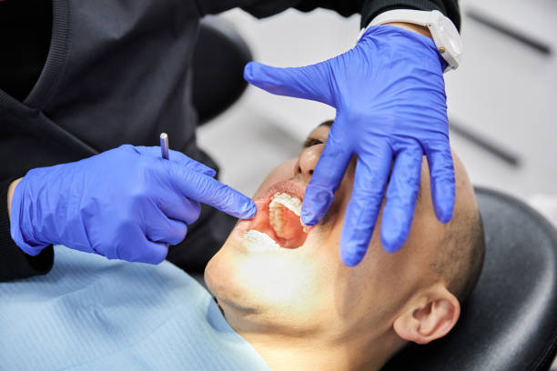 Best Chipped Tooth Repair Near Me  in Granville South, OH